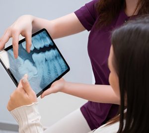Tooth Extractions Tooth Extractions