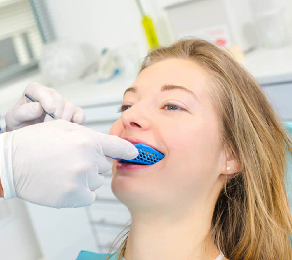 porcelain veneers near you