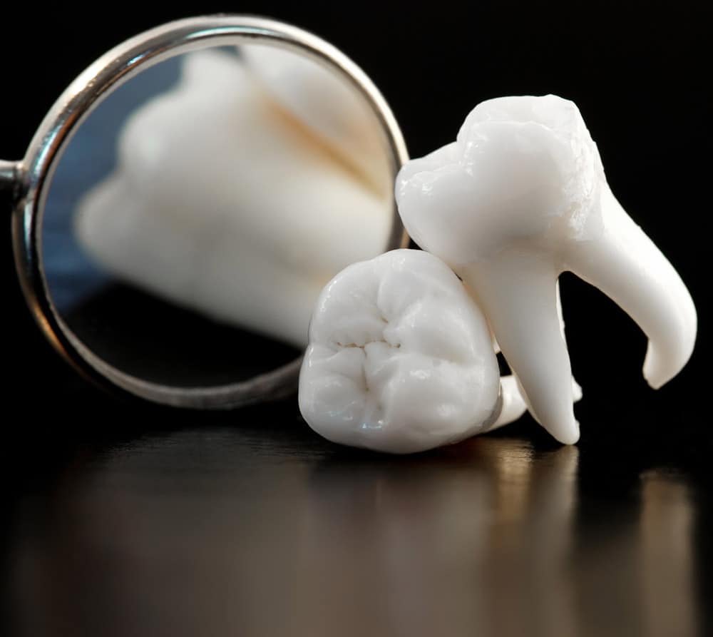 tooth extraction near you