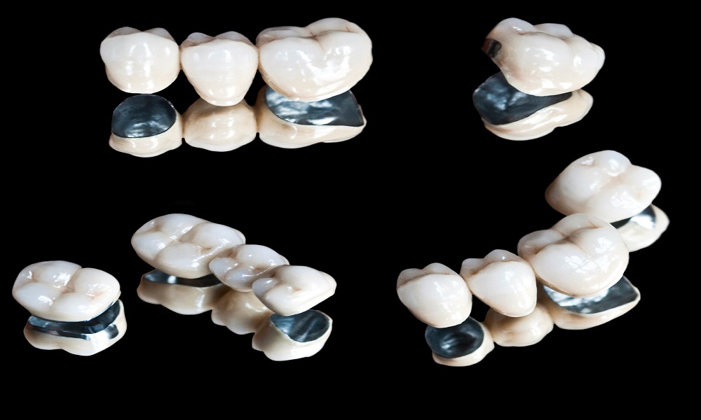 how do you clean under the dental bridge