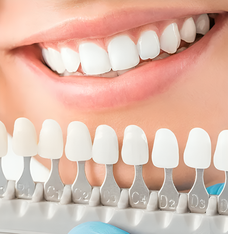Cosmetic dental in NE Calgary