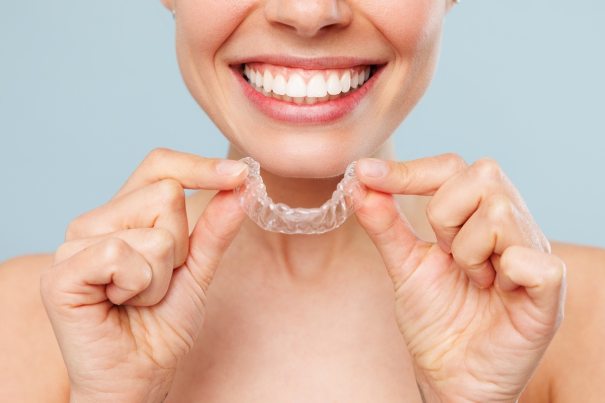 invisalign for gaps between teeth